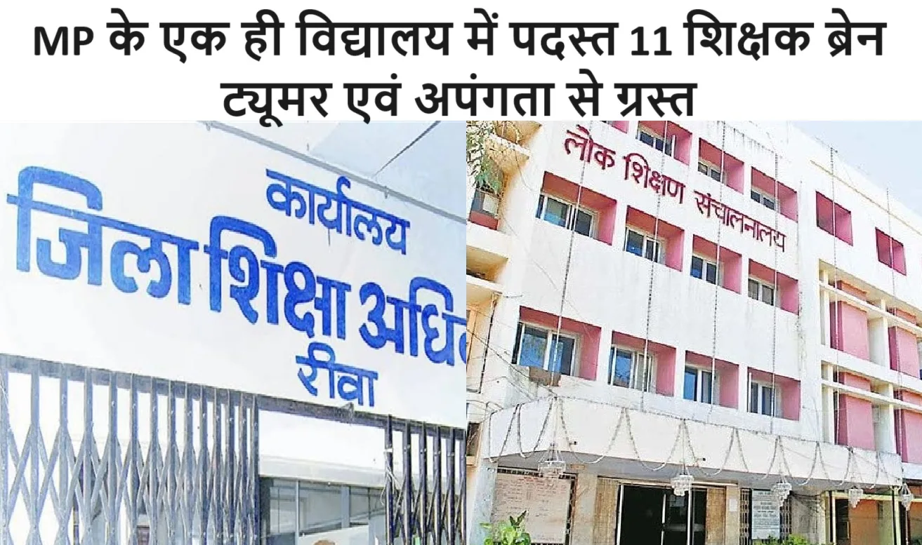 Madhya Pradesh Education Department News: MP के एक ही विद्यालय में पदस्त 11 शिक्षक ब्रेन ट्यूमर एवं अपंगता से ग्रस्त